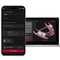 SprintRay NanoPrint - Software connesso e monitoraggio delle stampe