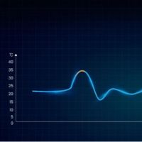 Tecnologia Revopoint Trackit