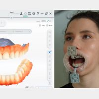 MetiSmile-MR tracciatori e marcatori