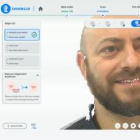 MetiSmile allineamento automatico